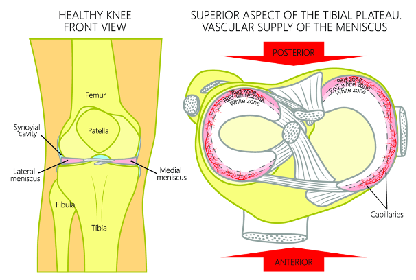 Binnen- en buitenmeniscus met aanhechting van kruisbanden